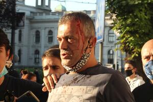 VIDEO Sergej Trifunović injured during the protest: I was attacked...