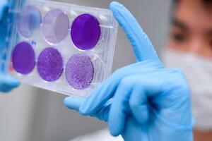 Šta sam saznao kao učesnik testova u Oksfordu