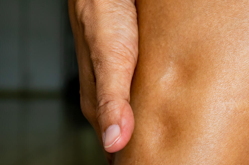 Ilustracija, Foto: Shutterstock