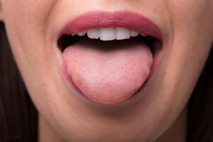 Šta o vašem zdravlju kaže - vaš jezik
