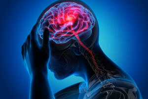 Kako prepoznati moždani udar: Simptomi i brzi test