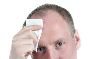 Prekomjerno znojenje: Ozbiljno je kad se znoje glava i vrat