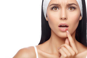 Herpes na usnama: Kako se liječi i ublažava?