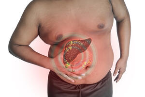 Masna jetra: Kako nastaje i zašto se ne smije zapustiti