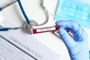 AFP: U svijetu više od 60 miliona ljudi zaraženo koronavirusom
