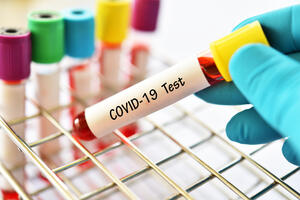 Preminula jedna osoba, 61 novi slučaj koronavirusa