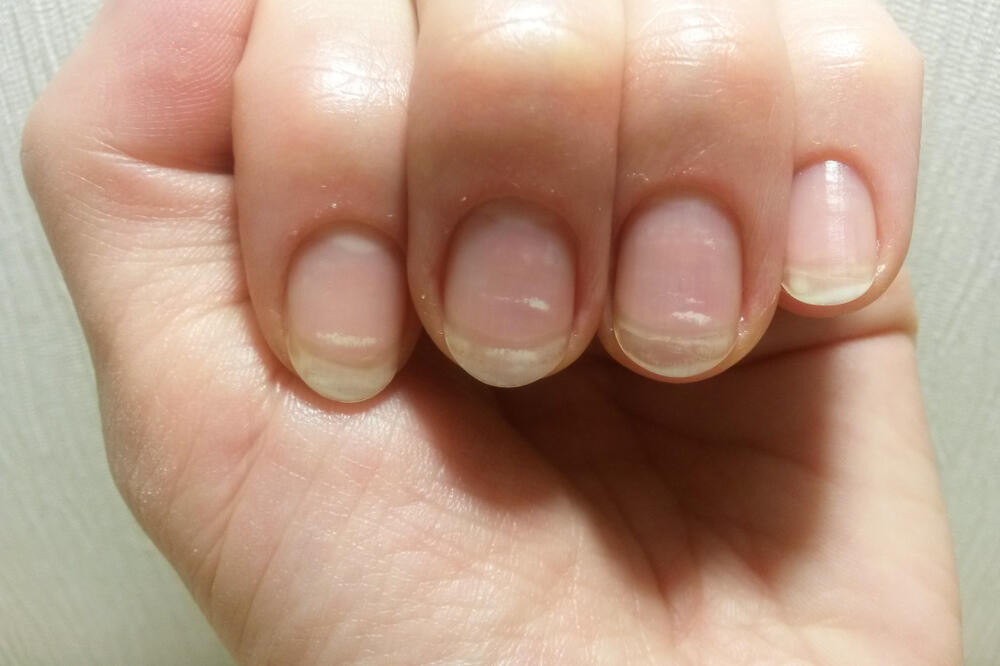 Ilustracija, Foto: Shutterstock