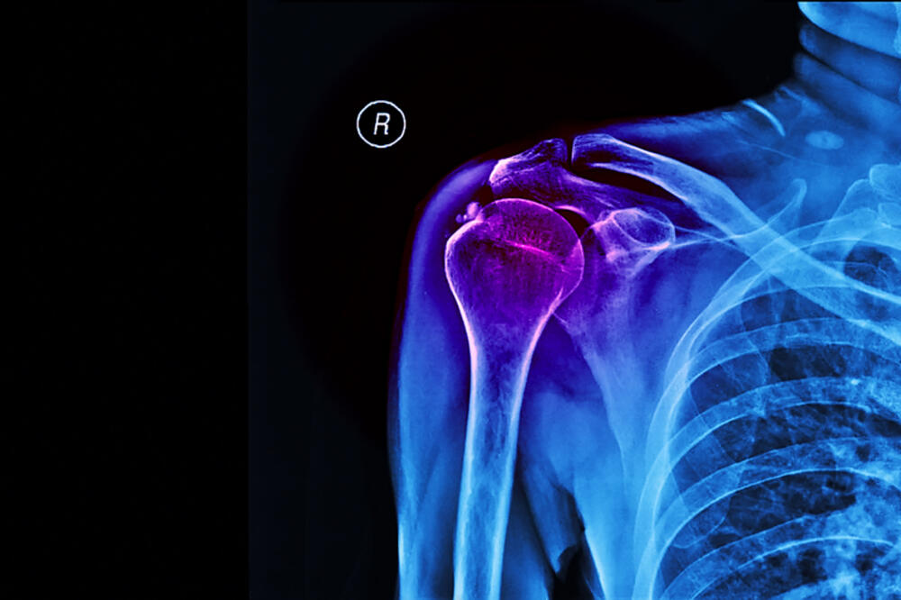 Ilustracija, Foto: Shutterstock