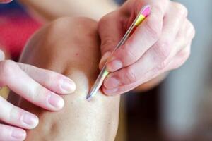 Dosadne su i ružne: Kako spriječiti urastanje dlačica?