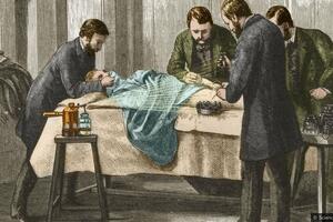 Epidemije, bolesti i higijena: Hirurzi koji su prvi očistili...