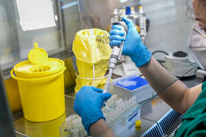IJZ: 174 nova slučaja koronavirusa, umrla dva pacijenta
