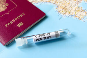 MEK: Besplatno PCR testiranje za turiste kojima je to potrebno za...