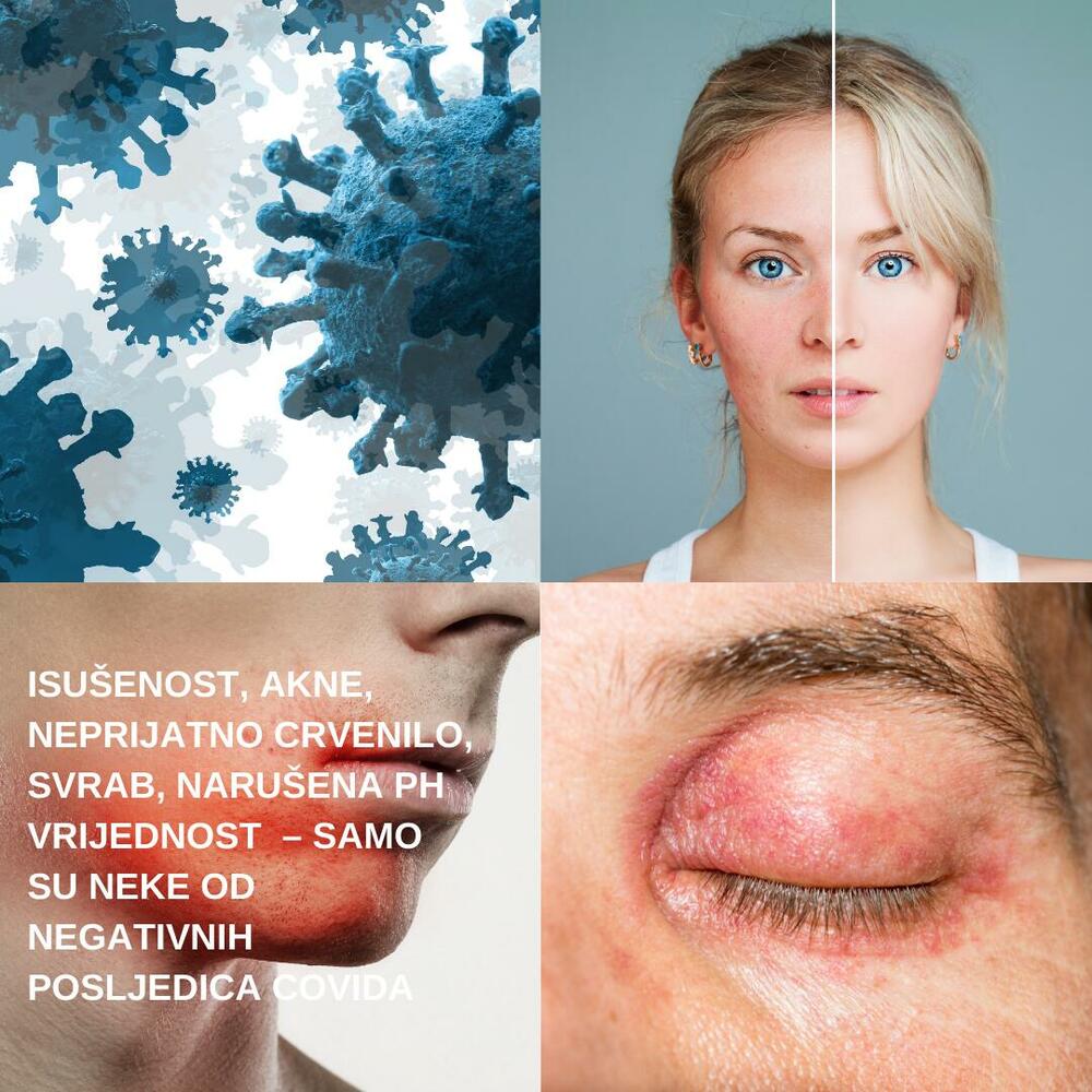 Koža nakon preležanog kovida