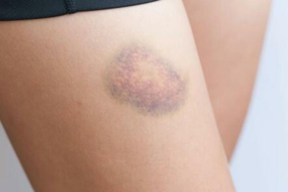 Ilustracija, Foto: Pinterest