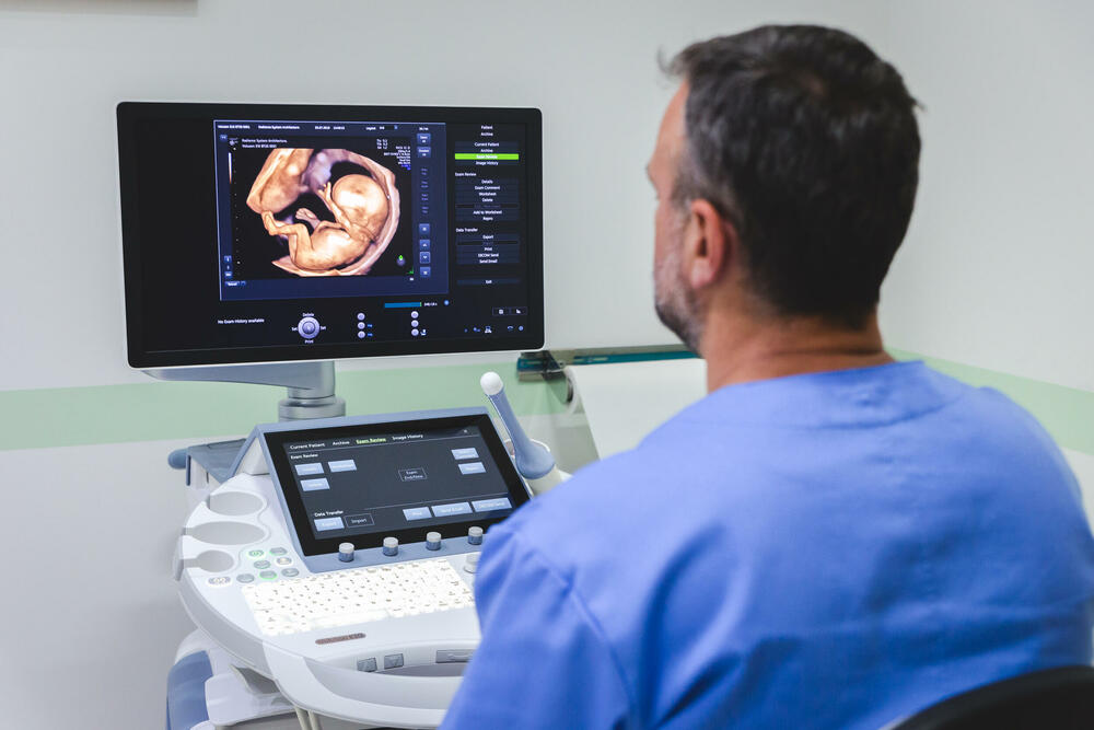 Najsavremeniji ultrazvučni aparat