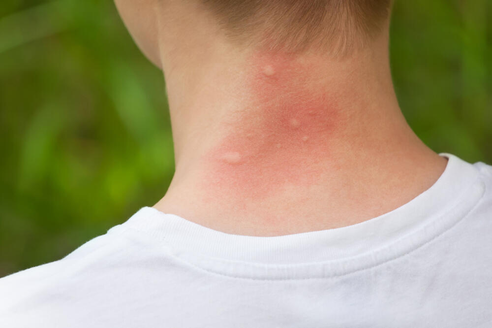 Ilustracija, Foto: Shutterstock