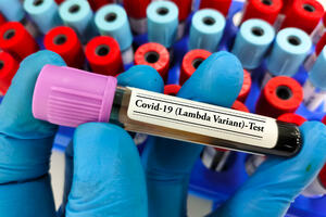 Japanska studija: Lambda soj koronavirusa otporniji na antitijela,...