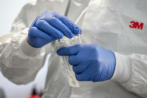 IJZ: Još 354 novopozitivna, među njima 56 turista