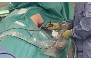 Od ovog mjeseca čuveni uroonkolog dr Krstanoski ordinira u Baru