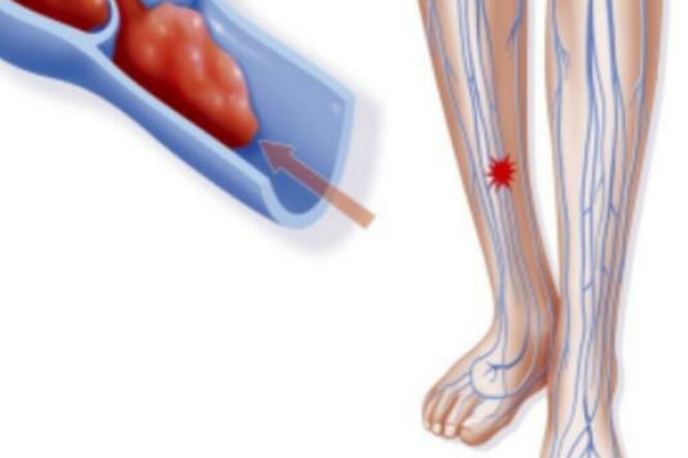 Ilustracija, Foto: Pinterest