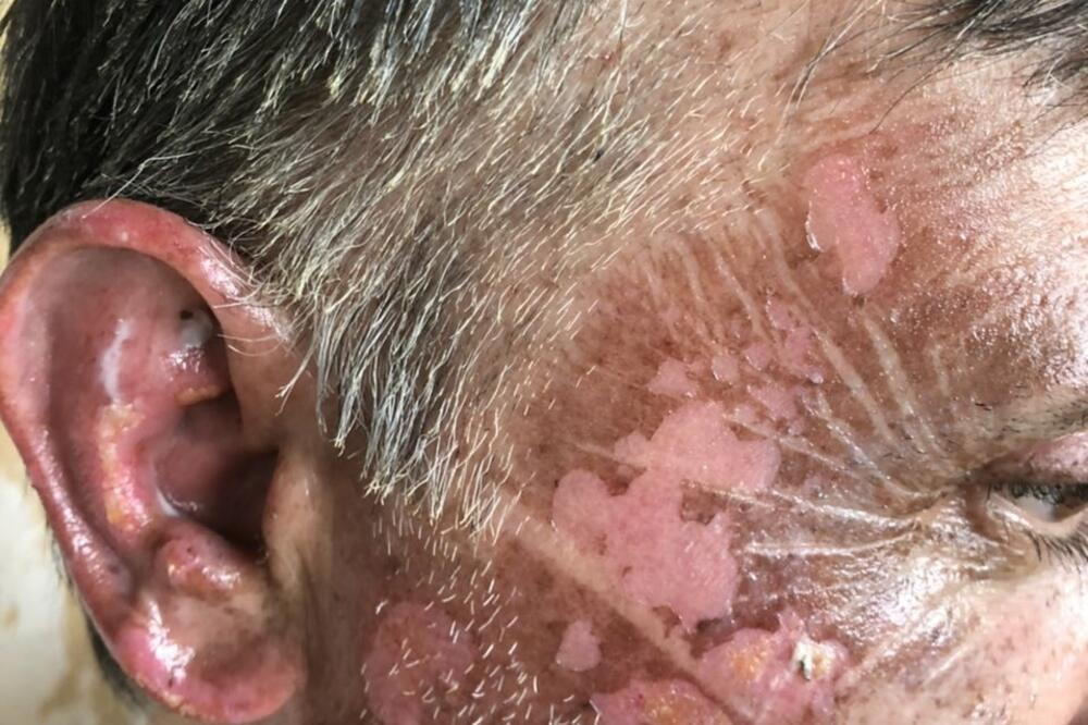 Jedan od provrijeđenih građana na Cetinju, Foto: Privatna arhiva