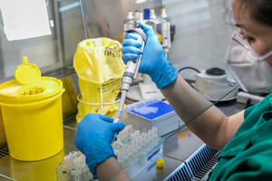 Preminulo 10 osoba, još 425 novopozitivnih