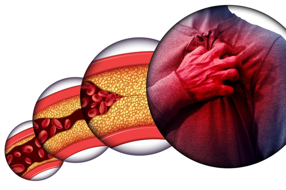 Ilustracija, Foto: Shutterstock