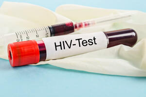 IJZCG: Testiranja na HIV i hepatitise B i C od 22. do 26. novembra