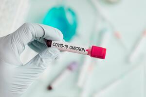 Prvi slučaj omikron soja koronavirusa otkriven u Nigeriji...