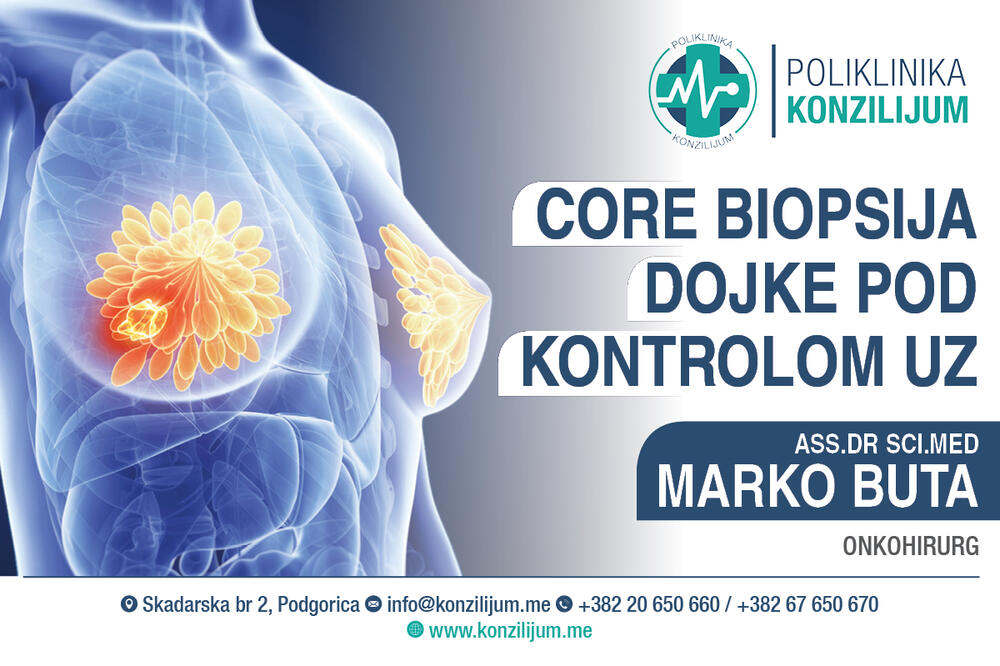 Foto: Poliklinika Konzilijum