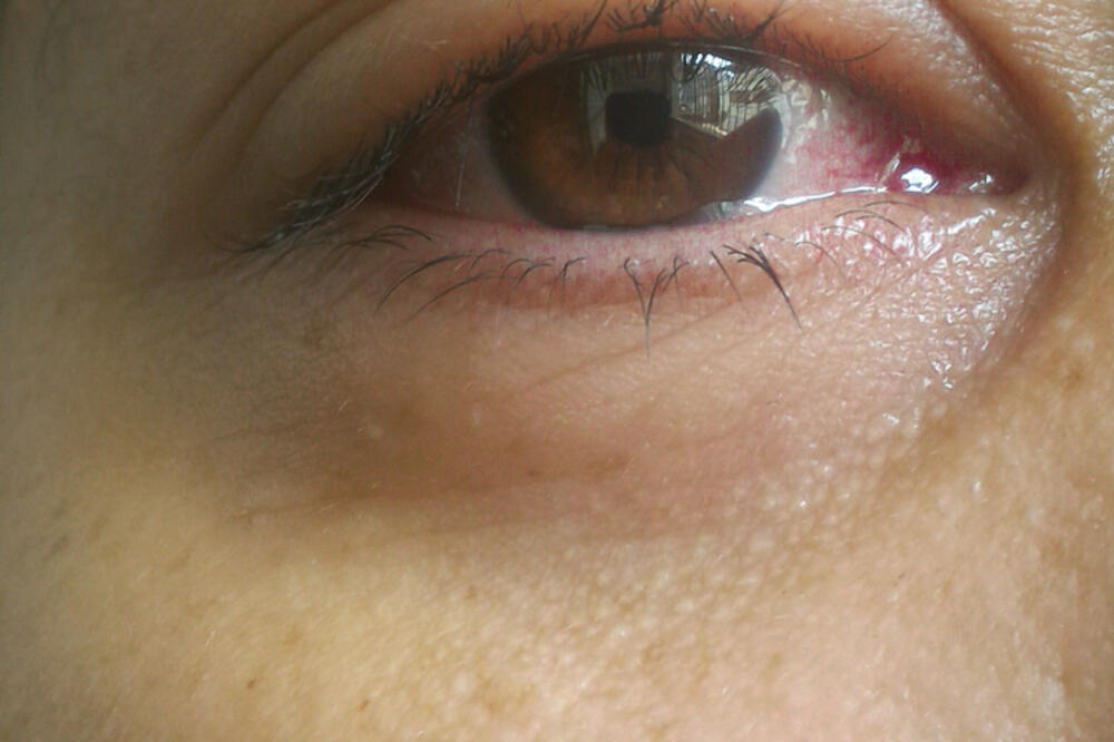 Ilustracija, Foto: Shutterstock