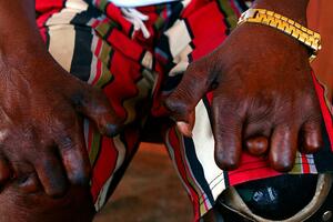 Žena čiji se život promenio kad je posetila koloniju leproznih