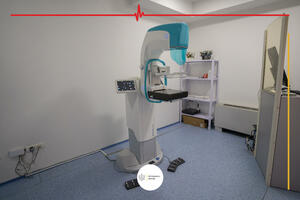 Digitalni mamograf u KCCG ponovo u funkciji