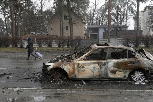 "Da li može da se napravi roze proteza sa cvjetićima" - priče...