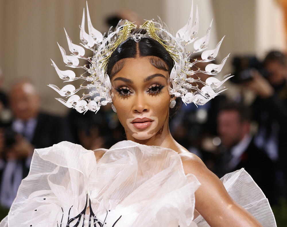 <p>Met Gala nosi epitet „najvećeg modnog izlaska” i dobrotvorna je akcija za prikupljanje sredstava za muzej umjetnosti "Metropoliten" u Njujorku. Događaj okuplja poznate iz svijeta šoubiznisa i mlade kreativne ljude.</p>