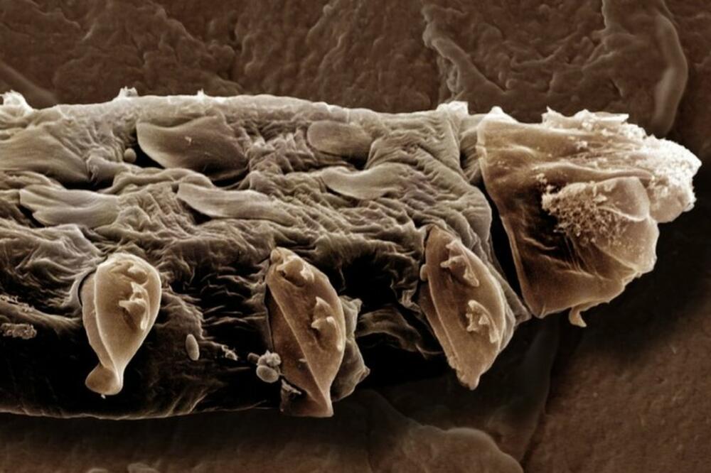 Da, ovo su grinje koje žive na našem licu, Foto: Getty Images