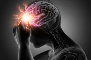Rizik od moždanog udara: 10 faktora na koje možemo da utičemo