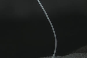 Otkrivena najveća bakteriju na svijetu