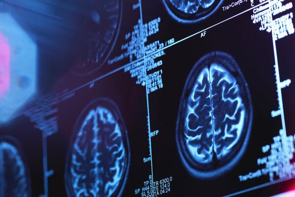 Može li vještačka inteligencija da pomogne u liječenju...