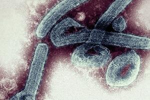 The first two cases of the deadly Marburg virus have been confirmed in Ghana