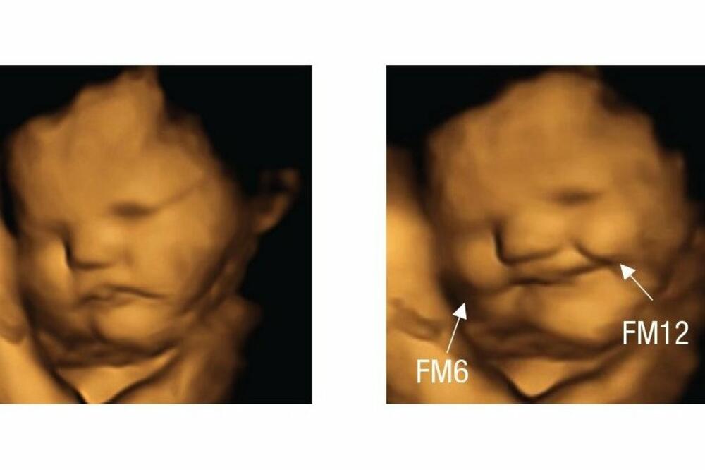 Foto: Fetal and Neonatal Research Lab, Durham University