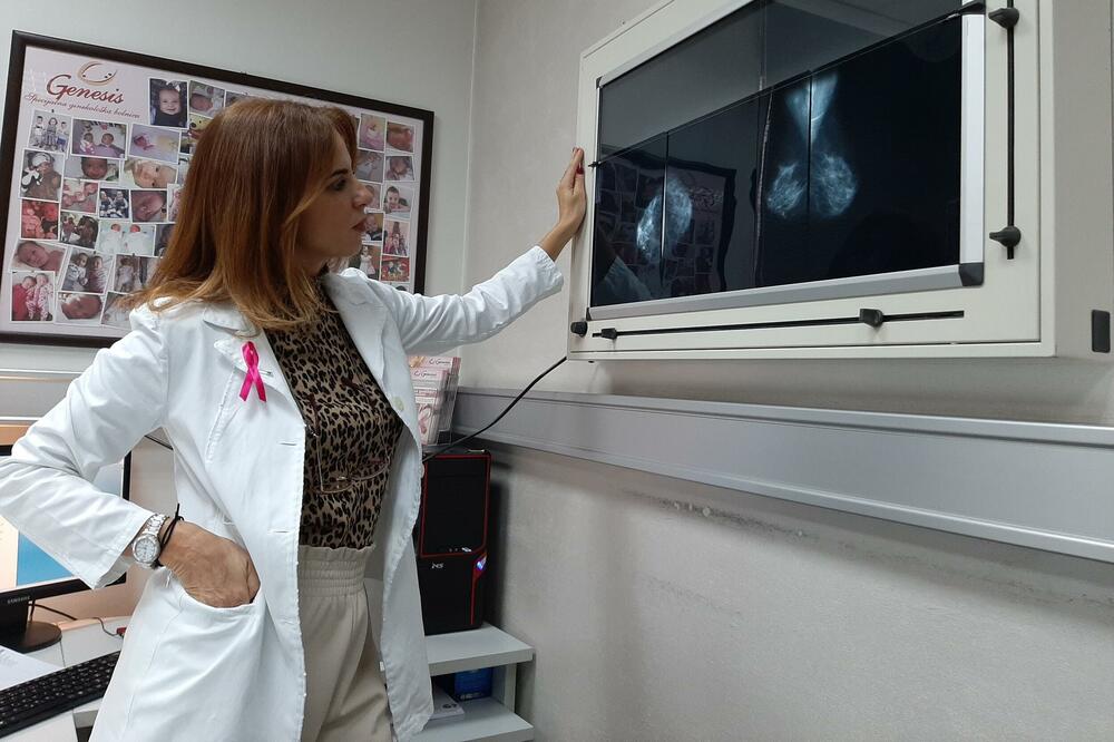 Mlađe žene treba da rade ultrazvučni, a starije od 40 godina mamografski pregled: Vučaj Ćirilović, Foto: SGB Genesis