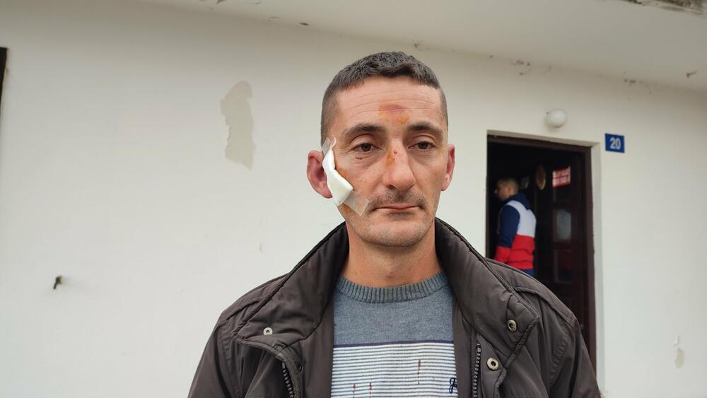 Sa birališta se vratio sa modricama i flasterima: Lazović 