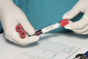 Testiranje na HIV od osam do 20 sati