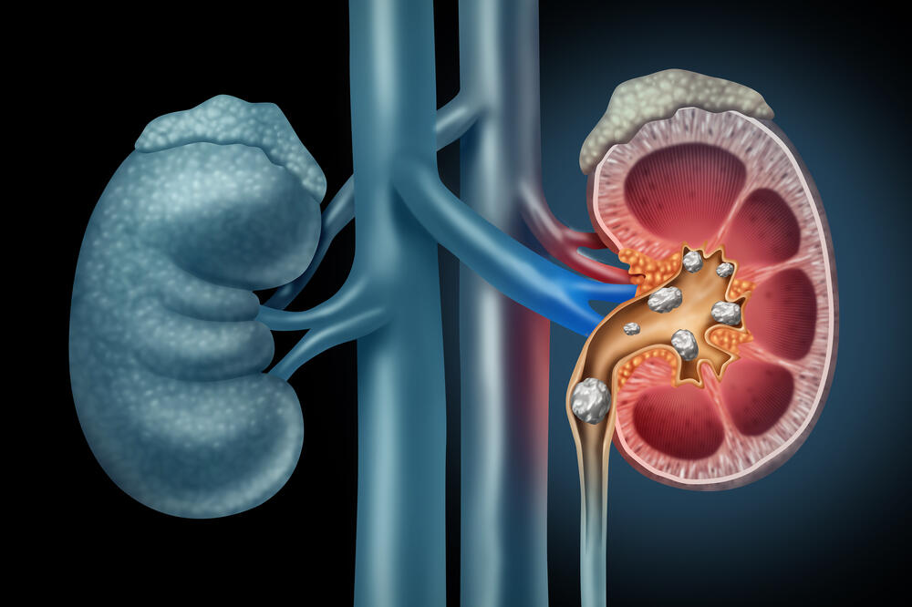 Ilustracija, Foto: Shutterstock