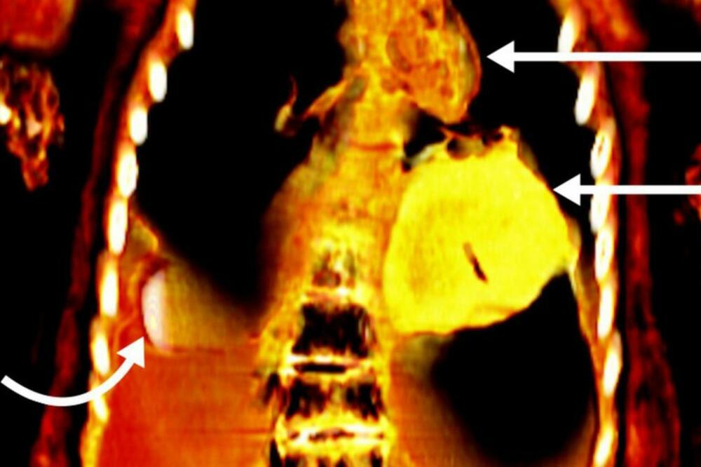 Foto: S.N. Saleem, S.A. Seddik, M. el-Halwagy
