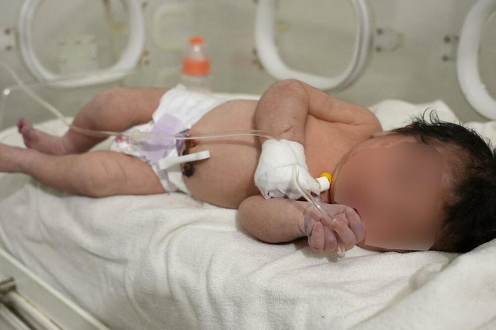 Beba je sada stabilno poslije dolaska u bolnicu sa modricama, posjekotinama i hipotermiojom, Foto: AFP