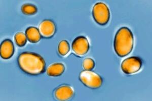 Gljivična infekcija hara američkim bolnicama