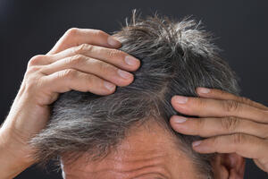 Naučnici otkrili zašto kosa sijedi: Može li se proces zaustaviti?