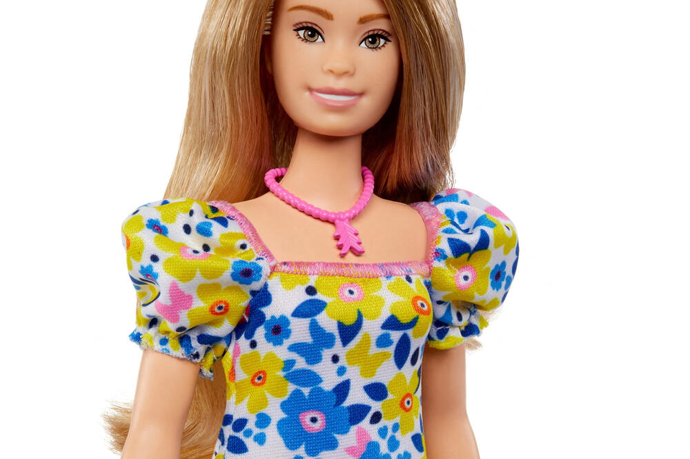 Barbika sa Daunovim sindromom, Foto: REUTERS